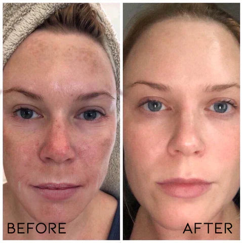 Rosemary Essential Oil - Free Today